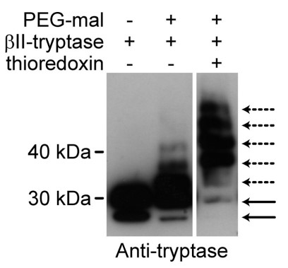 WB of βII-tryptase (1 μm) was incubated without or with thioredoxin.jpg